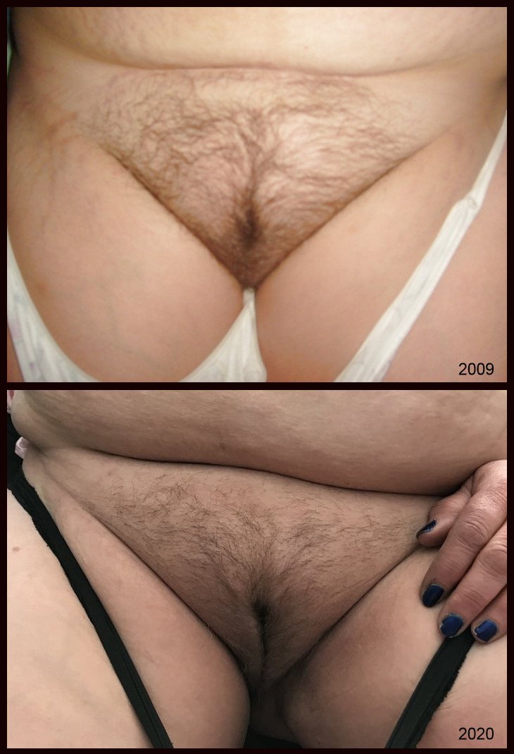 BBW "Belly Betty" Dressed/Undressed #e7drO2E4